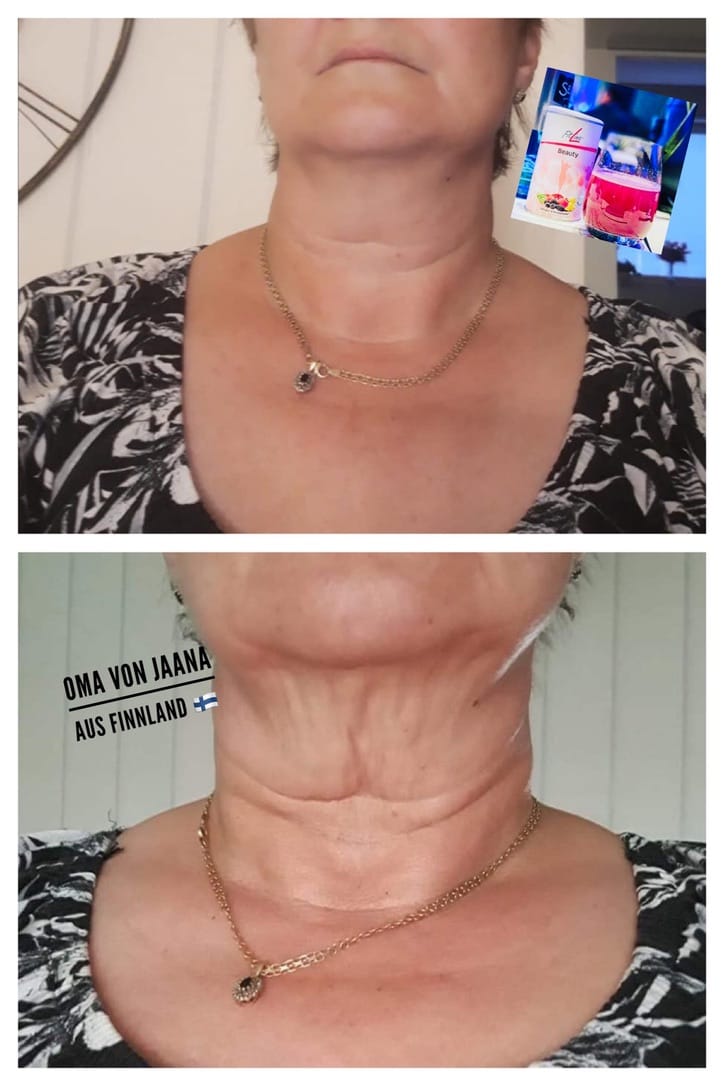 Eine ältere Person mit einem neutralen Ausdruck. Kette und blumiges Kleid, Fokus auf den Hals.